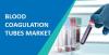 Photo for Blood Coagulation Tubes 2018–2026: Analysis, Status, Type, Application, Regions, Market Size by Players