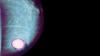 Photo for Breast Cancer Diagnostic Market To Reflect Significant Incremental Opportunity During 2018-2026