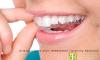 Photo for Orthodontists in Delhi | 9999201572 | Dentistry Redefined