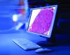 Photo for Digital Pathology Market – Global Industry Insights, Trends, Outlook, and Opportunity Analysis, 2018-2026