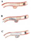 Photo for Cerebral Vascular Stent Market Analysis and Value Forecast Snapshot by End-use Industry 2019-2025