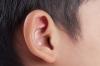 Photo for Outer Ear Infections - CMCL