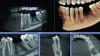 Photo for Cone Beam Computed Tomography (CBCT) Market Revenue Growth Predicted by 2018-2026