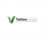 Photo for Tattoo Vanish