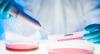 Photo for Cell Therapy Manufacturing Market Share and Forecasts, 2018-2026