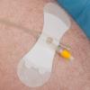 Photo for Catheter Stabilization Devices Market Set for Rapid Growth and Trend, by 2026
