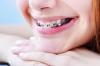 Photo for Orthodontic Supplies Market by 2026 Trending Report with its Key Vendor Analysis and Revenue
