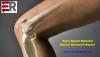 Photo for Bone Repair Material Market: By Industry Business Plan, Manufacturers, Sales, Supply, Revenue, Applications and Forecast Report 2014-2024