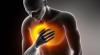 Photo for Acute Heart Failure Therapeutics Market Analysis By Industry Segment Outlook