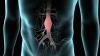 Photo for Abdominal Aortic Aneurysm Repair Devices Industry: Study Growth Factors, Types and Applications with Market Forecasts 2026