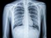 Photo for X-ray Market To Exhibit Ravishing Growth By 2026
