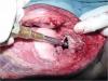 Photo for Metastatic Osteosarcoma Treatment Market 2019-2026: Instruments, Consumables
