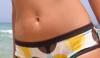 Photo for Permanent Hair Removal