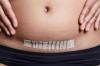 Photo for C Section Cost In Kolkata - Online Appointment On Credihealth