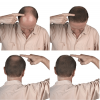 Photo for How to control Hair Fall?