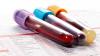 Photo for Global Liquid Biopsy Market - Growth,Trends and Forecast to 2025