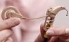 Photo for Artificial Cochlea Market To Reflect Significant Incremental Opportunity During 2018-2026