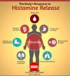 Photo for Excell Reports: Global Tissue Histamine Human Immunoglobulin Industry Trends and Forecast 2014–2024