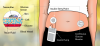 Photo for Continuous Glucose Monitoring Market Advancements in Technology and Product Innovations to Boost By 2024
