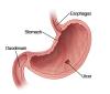 Photo for Gastritis Treatment Market Positive Long-Term Growth Outlook 2018-2026