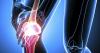 Photo for Orthopedic Bone Cement and Casting Materials Market Entry Strategies, Countermeasures of Economic Impact Channels to 2026