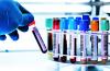 Photo for Global Clinical Laboratory Services Market, By Test Type and Service Provider - Trends, Analysis and Forecast till 2024