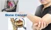 Photo for Bone Cancer Treatment Market With Focus On Growth Analysis By 2026