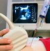 Photo for Amniocentesis Needle Market Revenue, Outlook, Segment, Competitive landscape and Forecast 2019-2024