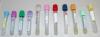 Photo for Light blue tube Phlebotomy Market – Global Industry Insights, Trends, Outlook, and Opportunity Analysis, 2018-2026