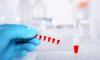 Photo for Biomarkers Market To See Incredible Growth By 2026