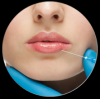 Photo for Dental Implants