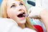 Photo for Impacted Wisdom Teeth Extraction Dentist in Melbourne