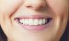 Photo for 7 Amazing Benefits You Can Get from Cosmetic Dentistry