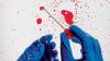 Photo for Proteomics Market Research Provides an In-Depth Analysis on the Future Growth Prospects and MGlobal Microbubble Contrast Media Market Trends Adopted by the Competitors