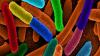 Photo for Cell Lysis Market - Competative analysis, Trends and Outlook 2017–2025