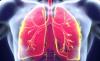 Photo for Non-Small Cell Lung Cancer Market Shows Expected Trend to Guide from 2018-2026 with Growth Analysis
