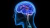 Photo for Neurologist in Faridabad - Book an Online Appointment - Credihealth