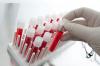 Photo for Blood Screening Market- Global Industry Size, Share, Analysis, and Forecast, 2018-2026