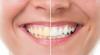 Photo for Looking for a professional dentist in Irving Tx?