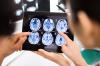 Photo for Cryptococcosis Treatment Market Analysis, Key Players, Growth Rate And Future Forecasts 2018-2026