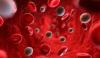 Photo for Blood Clotting Factors Market Predicted to Grow at a Moderate Pace Through 2026