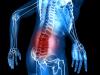 Photo for Postoperative Pain Management Market Size, Future Forecast, Key Manufactures And Industrial Opportunities To 2026