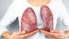 Photo for Lungs Specialist in Kolkata - Appointment On Credihealth