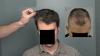Photo for Hair weaving service Noida | +91-9999629932