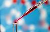 Photo for Liquid Biopsy Market Foresees Skyrocketing Growth in the Coming Years 2018-2026