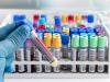 Photo for Autoimmune Disease Diagnostics Market 2026 - Diagnostic Testing and Interpretation of Tests