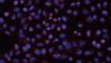 Photo for Life Cell Imaging Market Value Projected to Expand by 2018-2026