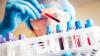 Photo for Monoclonal Antibody Diagnostic Reagents Market –Size, Share, and Analysis, 2018–2026