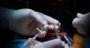 Photo for Vascular Graft Market is expected to register 7.6% CAGR till 2023 to garner USD 4.14 billion