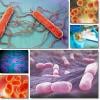 Photo for Listeria Monocytogenes Infections Treatment Market to Perceive Substantial Growth During 2018–2026